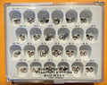 First Primary Molar Crowns Stainless Steel  Kit 72 units assorted Made in USA